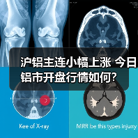 沪铝主连小幅上涨 今日铝市开盘行情如何？（图1）